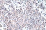 DNMT3A Antibody in Immunohistochemistry (Paraffin) (IHC (P))