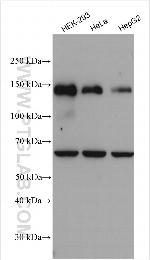 DNMT3A Antibody in Western Blot (WB)