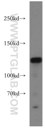 DNMT3A Antibody in Western Blot (WB)