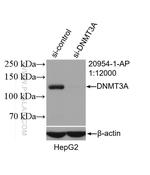 DNMT3A Antibody in Western Blot (WB)