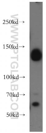 DNMT3A Antibody in Western Blot (WB)