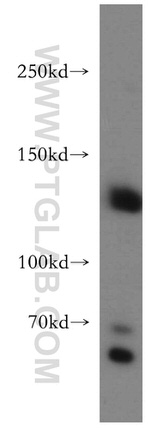 DNMT3A Antibody in Western Blot (WB)