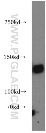 DNMT3A Antibody in Western Blot (WB)