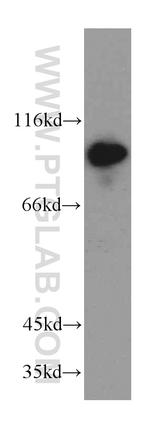 Advillin Antibody in Western Blot (WB)