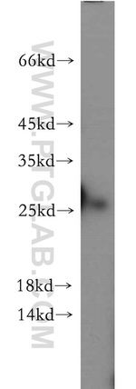 C1orf50 Antibody in Western Blot (WB)