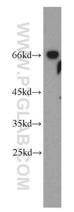 MRPP3 Antibody in Western Blot (WB)