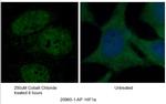 HIF1a Antibody in Immunocytochemistry (ICC/IF)