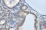 HIF1a Antibody in Immunohistochemistry (Paraffin) (IHC (P))