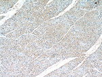 HIF1a Antibody in Immunohistochemistry (Paraffin) (IHC (P))