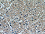 HIF1a Antibody in Immunohistochemistry (Paraffin) (IHC (P))