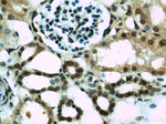 HIF1a Antibody in Immunohistochemistry (Paraffin) (IHC (P))