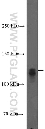 HIF1a Antibody in Western Blot (WB)