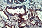 PYCR1 Antibody in Immunohistochemistry (Paraffin) (IHC (P))