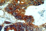 PYCR1 Antibody in Immunohistochemistry (Paraffin) (IHC (P))