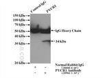 PYCR1 Antibody in Immunoprecipitation (IP)