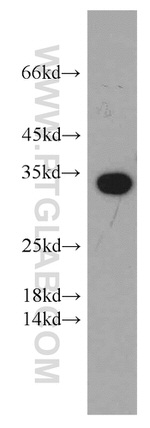 PYCR1 Antibody in Western Blot (WB)