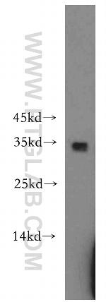 PYCR1 Antibody in Western Blot (WB)