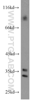 PYCR1 Antibody in Western Blot (WB)