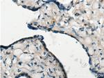 EDNRB Antibody in Immunohistochemistry (Paraffin) (IHC (P))