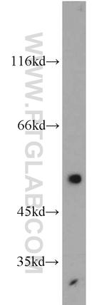 EDNRB Antibody in Western Blot (WB)