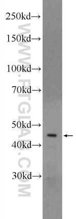 CRHR1 Antibody in Western Blot (WB)