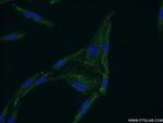 CYP11B2 Antibody in Immunocytochemistry (ICC/IF)