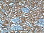 CYP11B2 Antibody in Immunohistochemistry (Paraffin) (IHC (P))