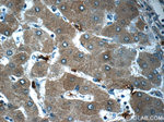 CYP11B2 Antibody in Immunohistochemistry (Paraffin) (IHC (P))