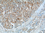 CYP11B2 Antibody in Immunohistochemistry (Paraffin) (IHC (P))