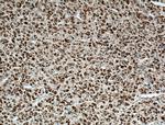 CYP11B2 Antibody in Immunohistochemistry (Paraffin) (IHC (P))