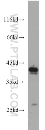 DEPDC6/Deptor Antibody in Western Blot (WB)