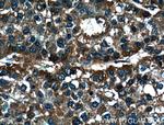 DEPDC6/Deptor Antibody in Immunohistochemistry (Paraffin) (IHC (P))