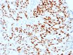 Estrogen Receptor, alpha (Marker of Estrogen Dependence) Antibody in Immunohistochemistry (Paraffin) (IHC (P))