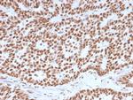 Estrogen Receptor, alpha (Marker of Estrogen Dependence) Antibody in Immunohistochemistry (Paraffin) (IHC (P))