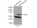 TMEM106B Antibody in Immunoprecipitation (IP)