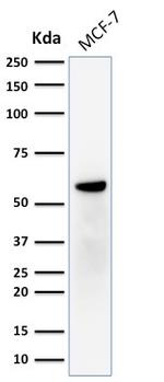 ER-beta-1 (Estrogen Receptor beta-1) Antibody in Western Blot (WB)