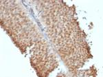 ER-beta-1 (Estrogen Receptor beta-1) Antibody in Immunohistochemistry (Paraffin) (IHC (P))