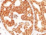 ER-beta-1 (Estrogen Receptor beta-1) Antibody in Immunohistochemistry (Paraffin) (IHC (P))