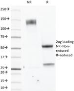 ER-beta-1 (Estrogen Receptor beta-1) Antibody in SDS-PAGE (SDS-PAGE)