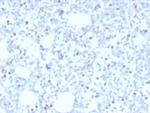 ER-beta (Estrogen Receptor beta-1) Antibody in Immunohistochemistry (Paraffin) (IHC (P))