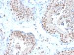 ER-beta (Estrogen Receptor beta-2) Antibody in Immunohistochemistry (Paraffin) (IHC (P))