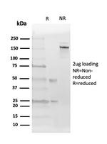 ER-beta (Estrogen Receptor beta-2) Antibody in SDS-PAGE (SDS-PAGE)