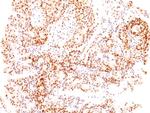 ER-beta-1 (Estrogen Receptor beta-1) Antibody in Immunohistochemistry (Paraffin) (IHC (P))