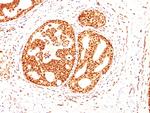 ER-beta-1 (Estrogen Receptor beta-1) Antibody in Immunohistochemistry (Paraffin) (IHC (P))