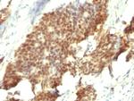 ER-beta-1 (Estrogen Receptor beta-1) Antibody in Immunohistochemistry (Paraffin) (IHC (P))