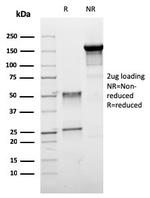 ER-beta-1 (Estrogen Receptor beta-1) Antibody in SDS-PAGE (SDS-PAGE)