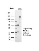 ER-beta-1 (Estrogen Receptor beta-1) Antibody in SDS-PAGE (SDS-PAGE)