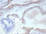 ER-beta (Estrogen Receptor beta-1) Antibody in Immunohistochemistry (Paraffin) (IHC (P))