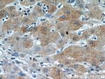 PDXDC1 Antibody in Immunohistochemistry (Paraffin) (IHC (P))