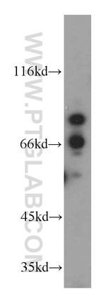 PDXDC1 Antibody in Western Blot (WB)